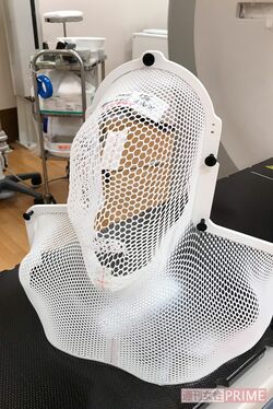 杉田さんの顔の形に合わせた放射線治療用のマスク