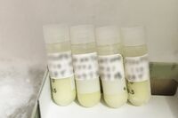 余命5か月の患者が3年生きられたケースも！「がん免疫療法」の実態と気になる費用