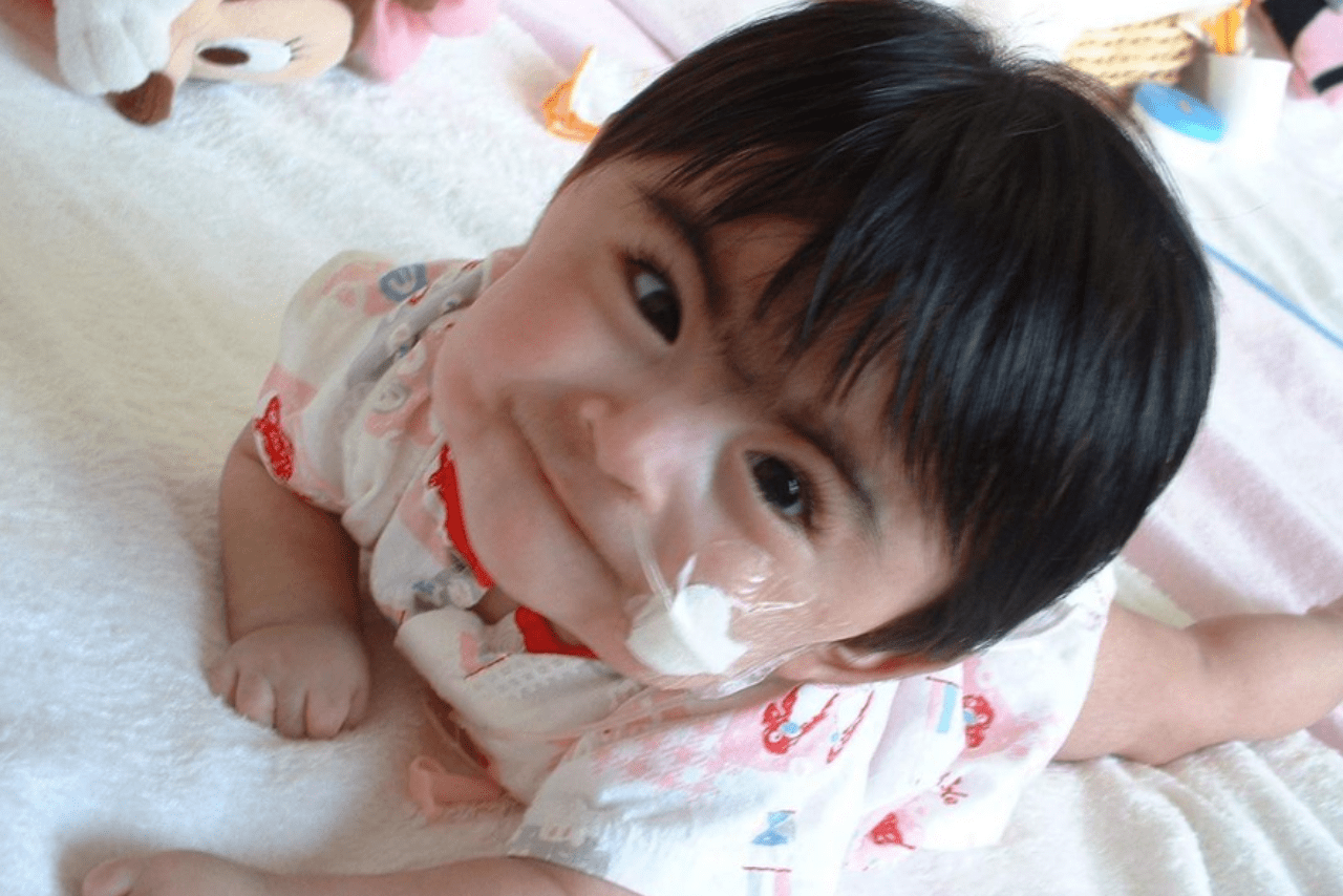 乳児のころの、このはさん。両眉がつながっているのは病気の症状