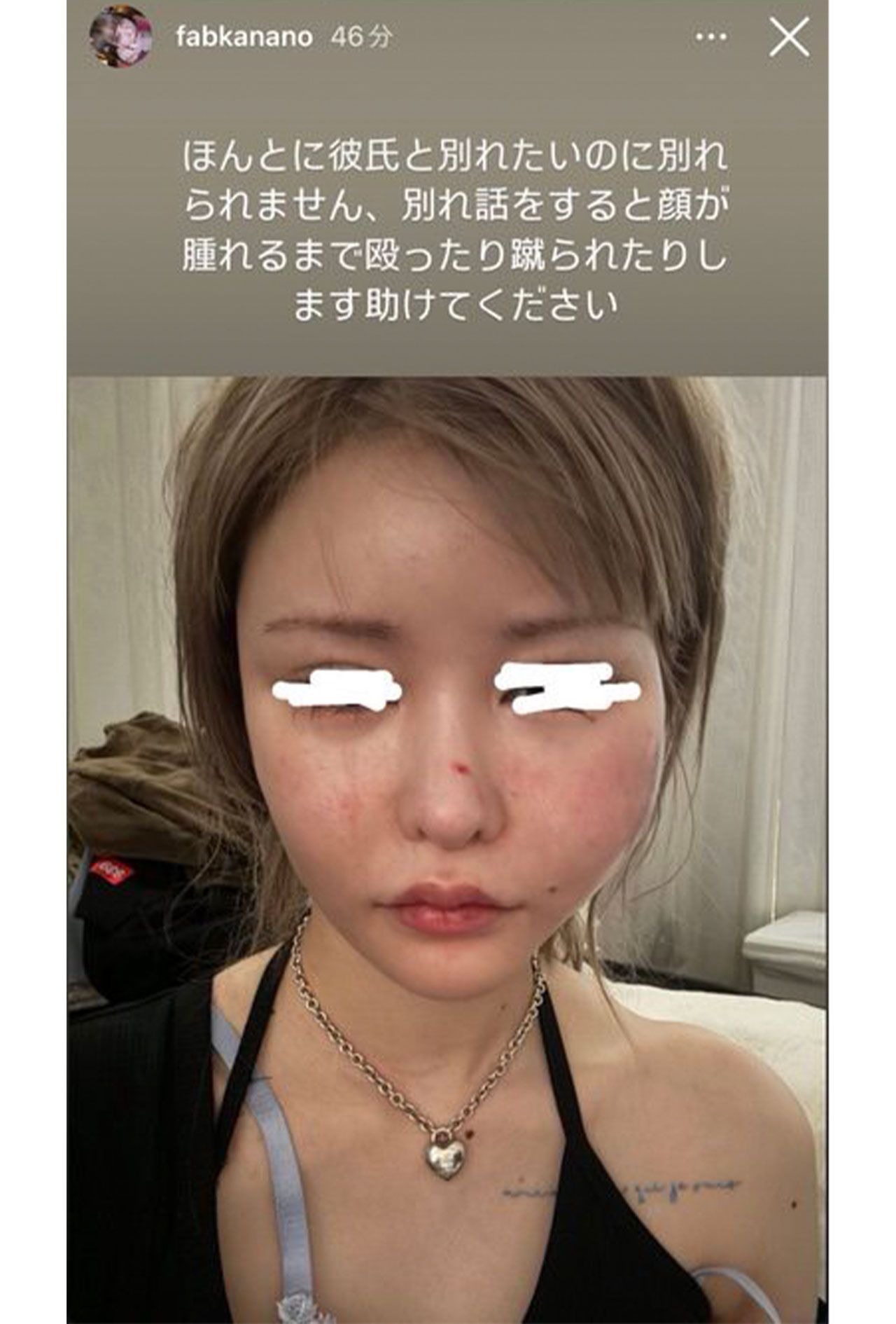 SNSでDV被害を訴えた戦慄かなの（本人の公式Instagramより）