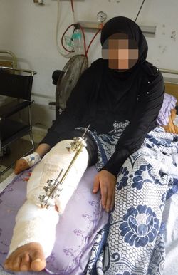 ガザの封鎖解除を求める抗議デモで負傷した女性（プライバシー保護のため一部編集しています）