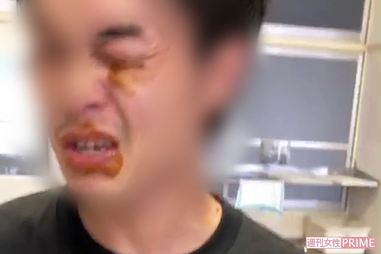 目にもカレーがつけられたX教員