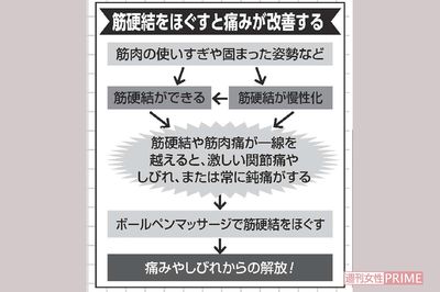 筋硬結をほぐすと痛みが改善する