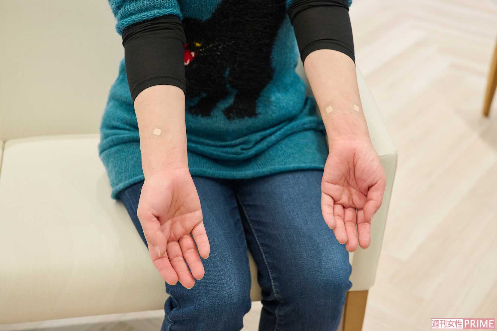 治療完了!!　柏屋コッコさん「アツアツビリビリパンパンだ〜」奥野祐次先生「10分くらいで引いてきますよ」