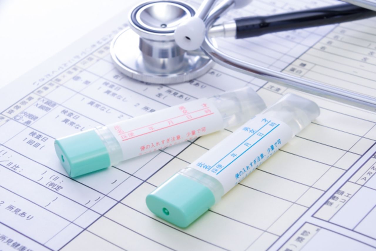 大腸がん検診（便潜血検査）は、大腸がんの早期発見に有効な検査。「陽性になったら必ず精密検査を受けてほしい」