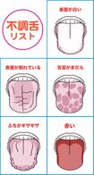 不調舌リスト イラスト/上田惣子