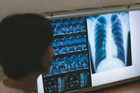 【知って楽しい雑学】「健診」と「検診」どう違うの？同じ“けんしん”でも全然違う！週女世代に受けてほし…