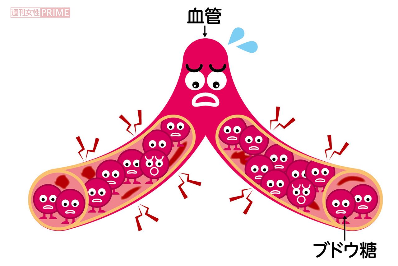 血糖値のイメージ　イラスト／西田ヒロコ