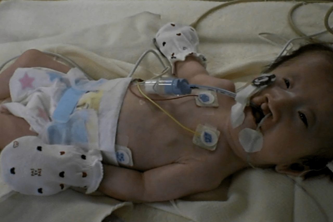生まれたばかりの晴琉さん。出産後に障害があることがわかり、8か月間入院することに