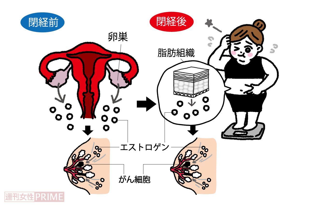 乳がんを大きくする女性ホルモンは閉経後は皮下脂肪でつくられる！