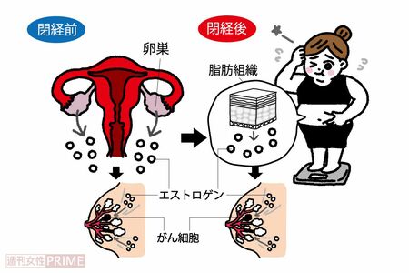 乳がんを大きくする女性ホルモンは閉経後は皮下脂肪でつくられる！