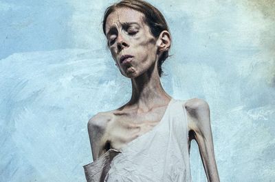 摂食障害とともに生きる「痩せ姫」たちの世界観、彼女たちが抱える “心の闇”