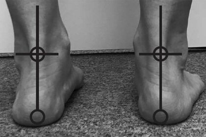 歪みのない正常なかかと。疲れにくく不調も起きにくい