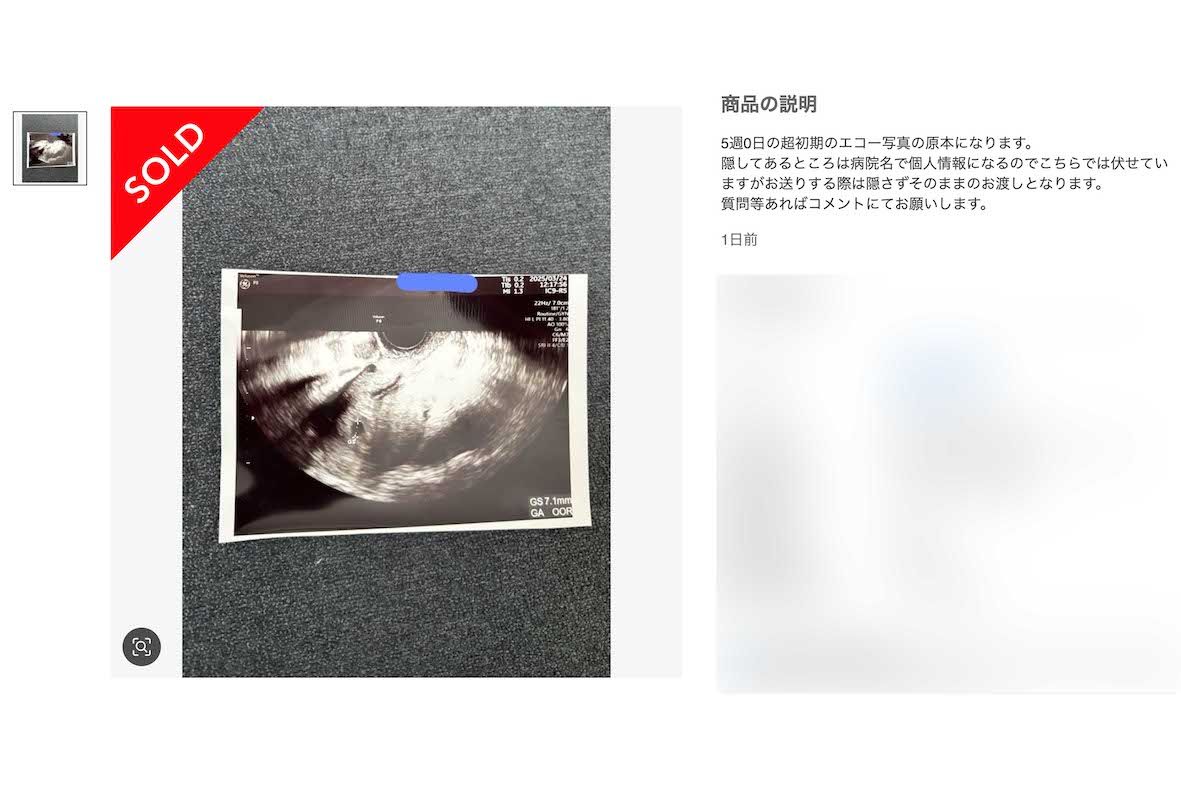 メルカリで販売されていた「胎児のエコー写真」