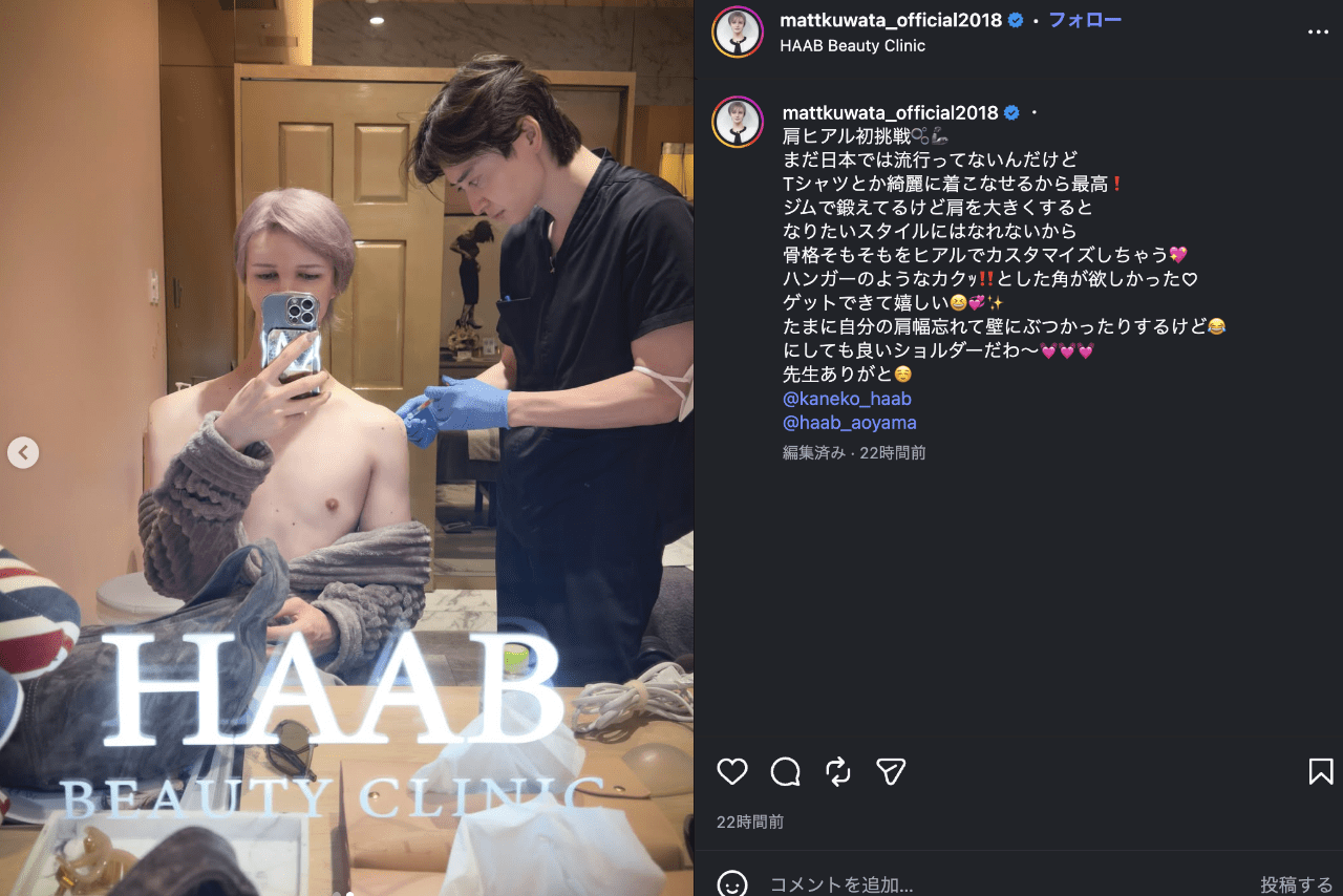 肩にヒアルロン酸を注入する美容整形を受けたと報告したMatt（公式インスタグラムより）