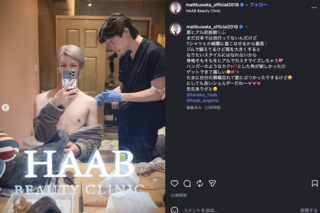 肩にヒアルロン酸を注入する美容整形を受けたと報告したMatt(公式インスタグラムより)