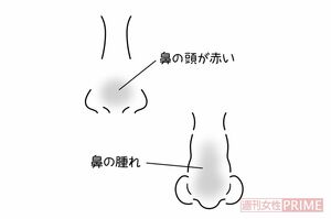 不自然な腫れ　イラスト／石崎伸子