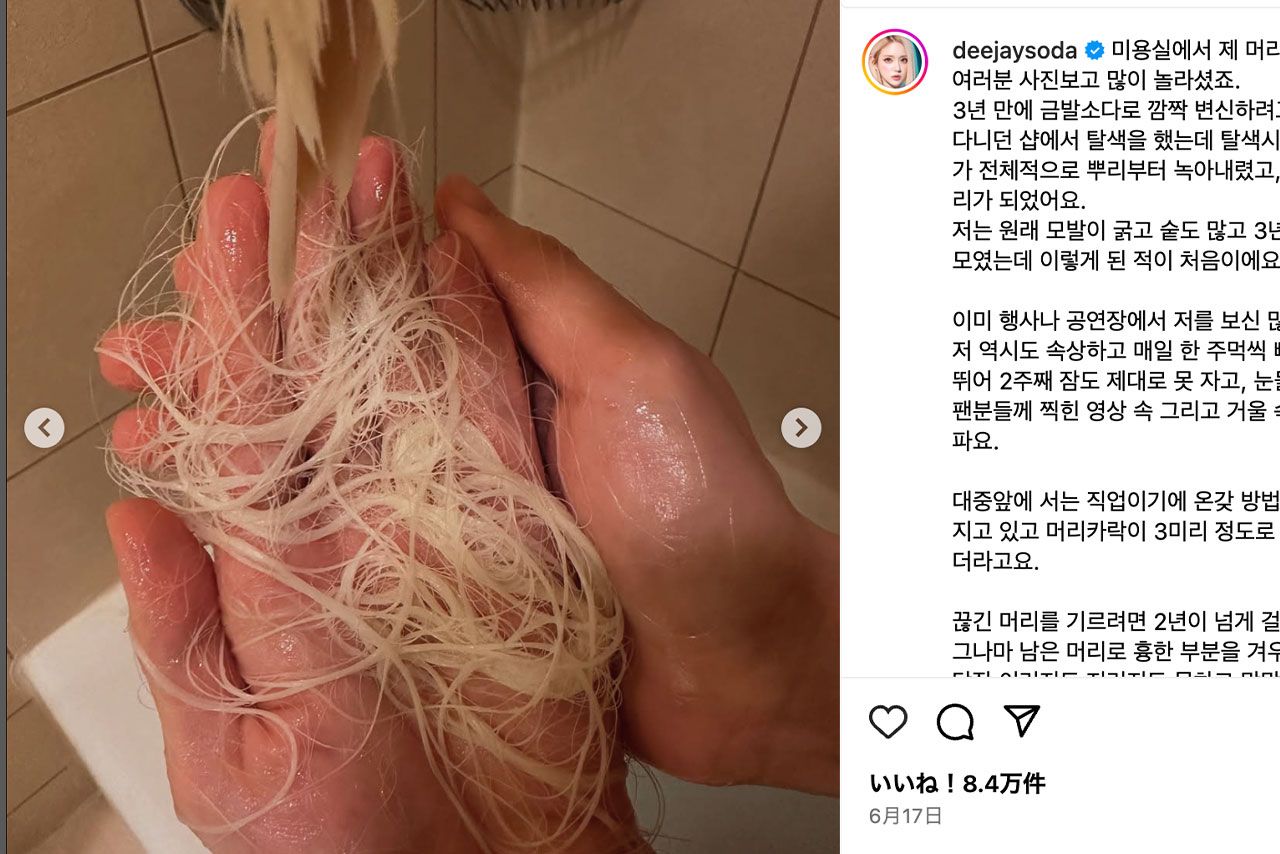 髪が抜けたことを報告した韓国のDJ SODA（本人の公式インスタグラムより）