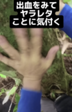 熊に噛まれた瞬間は痛みを感じなかったというが太ももと腕を負傷(YouTubeチャンネルより)