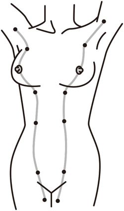 乳腺は両ワキから乳首を通って内股の方向へと流れている。そのライン上にある黒い点の部分に副乳ができやすい　イラスト／スヤマミヅホ