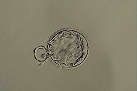 女性のキャリアプランにかかわる出産にも多様性が求められている（写真はイメージです）