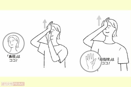 眼窩上げ　イラスト／高橋マサエ