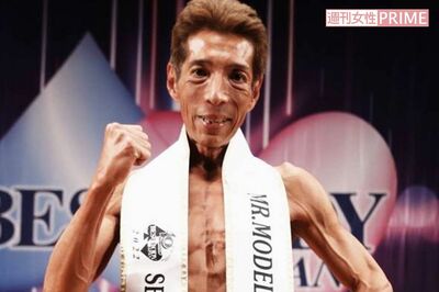 【独占告白】ゴージャス松野、パートナーに生体腎移植を決意！「手術の傷跡は勲章になるでしょう」