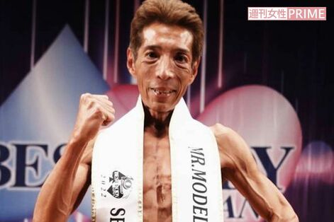 【独占告白】ゴージャス松野、パートナーに生体腎移植を決意!「手術の傷跡は勲章になるでしょう」