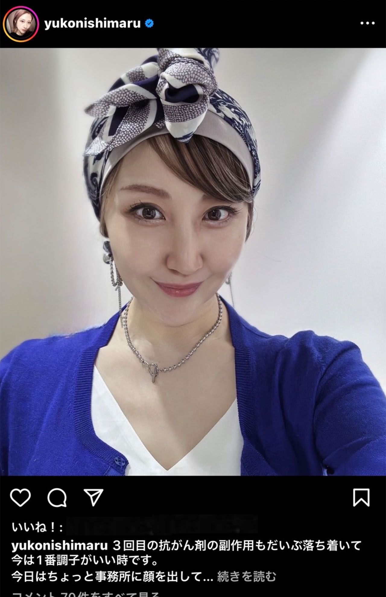 ウィッグなどでファッションにアレンジを。まつげもなくなってしまったけれど、顔のうぶ毛がなくなってお肌はツルツルと笑う西丸さん（西丸優子さんのInstagramより）