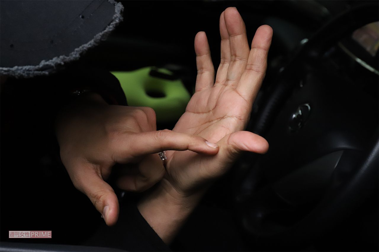 カイヤが運転する車に飛び乗ったが、加速されて振り落とされたときにできた傷を見せる麻世