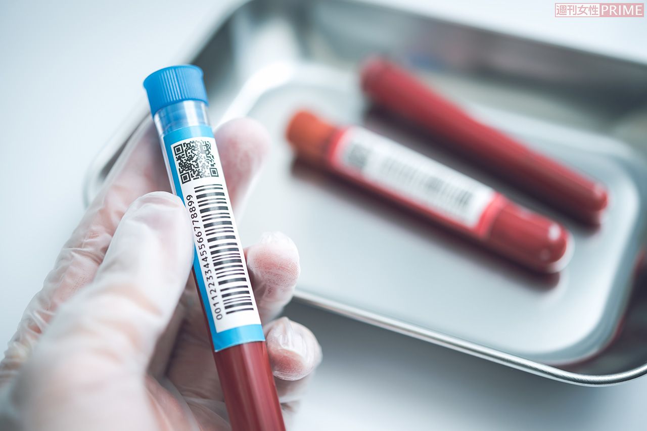 血液型による発症リクスや重症化リスクの違いが、複数の研究報告で指摘されている　※写真はイメージです