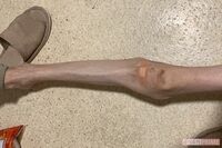 ダイエッターや“体重20キロ台の摂食障害”に苦しむ人たちが、もっとも言われたくない「8つの言葉」、現代…