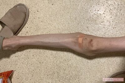 ダイエッターや“体重20キロ台の摂食障害”に苦しむ人たちが、もっとも言われたくない「8つの言葉」、現代…