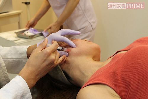 ボトックス注射を体験。痛みはほとんど感じない！