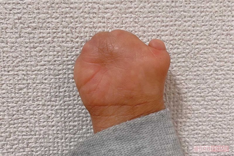 右手の写真。神経も通っていて、手のひらには手相もあると教えてくれた