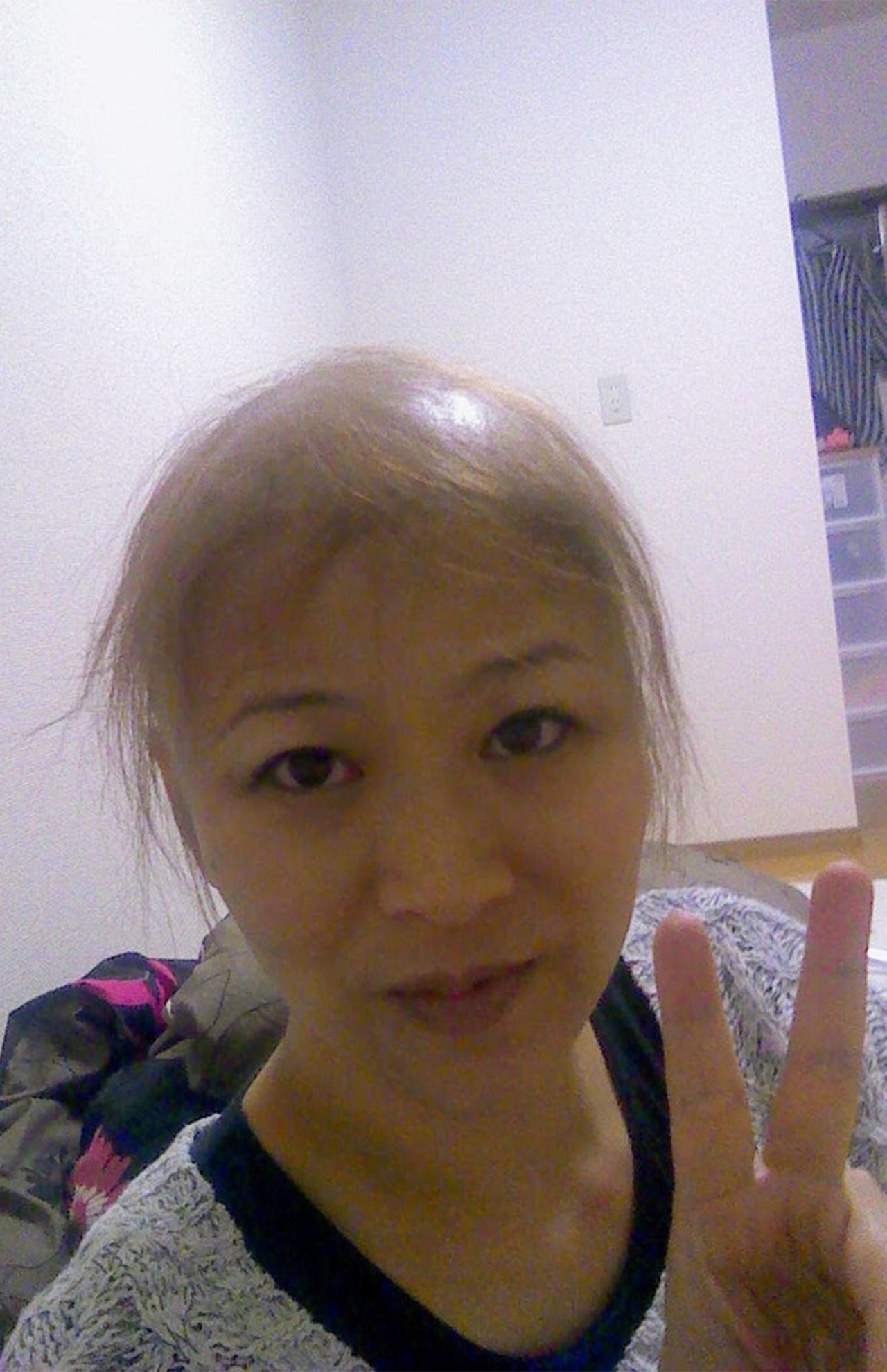 抗がん剤の副作用で脱毛が進んだ善本さん。しばらくはウィッグをつけて生活していた