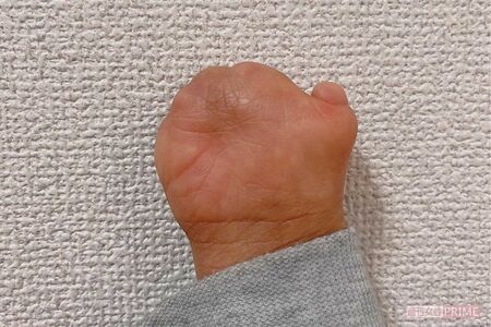 右手の写真。神経も通っていて、手のひらには手相もあると教えてくれた