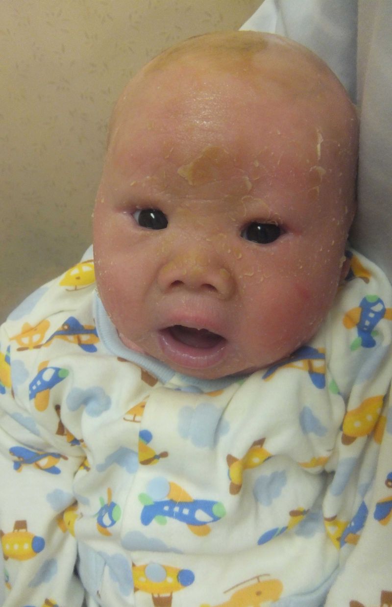 退院後まもない賀久くん。笑顔の裏に闘いの日々があった