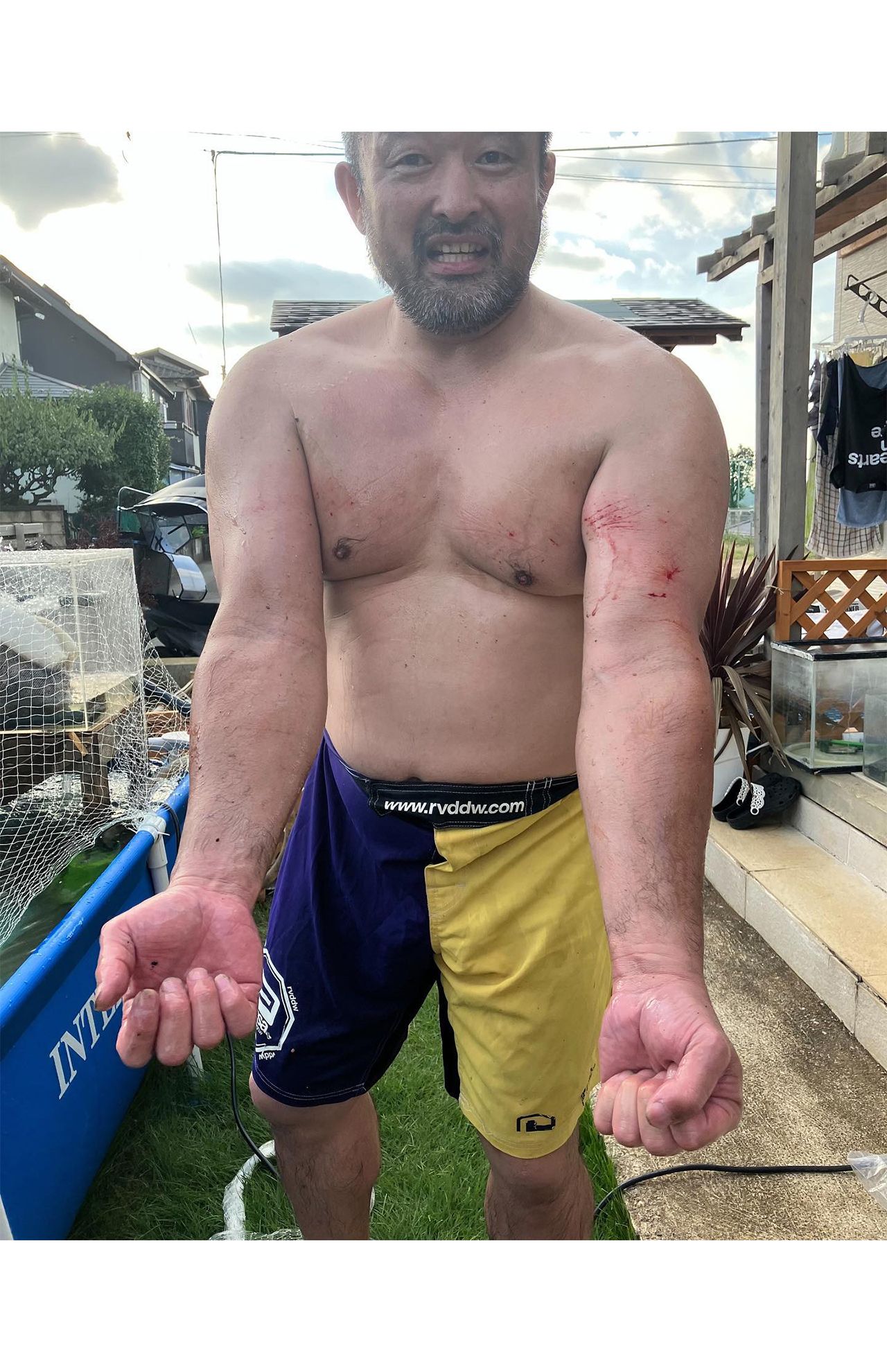 大型業をプールに移す際、擦り傷ばらけで血まみれになる江口容疑者（本人のSNSより）