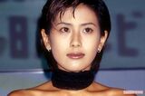長谷川理恵「ハリネズミみたい」ルート治療に感激！窪…