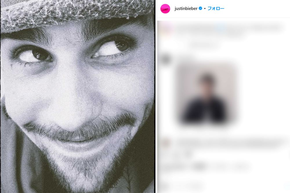 近影に心配の声が集まったジャスティン・ビーバー（本人インスタグラムより）