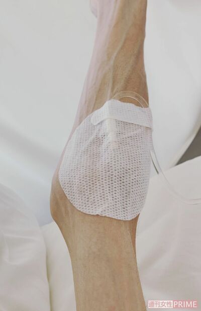 貧血や低カリウム血症などの不調があり、点滴や鉄剤輸液で補ったりしている