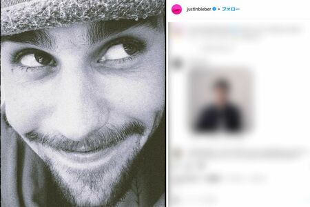 近影に心配の声が集まったジャスティン・ビーバー（本人インスタグラムより）