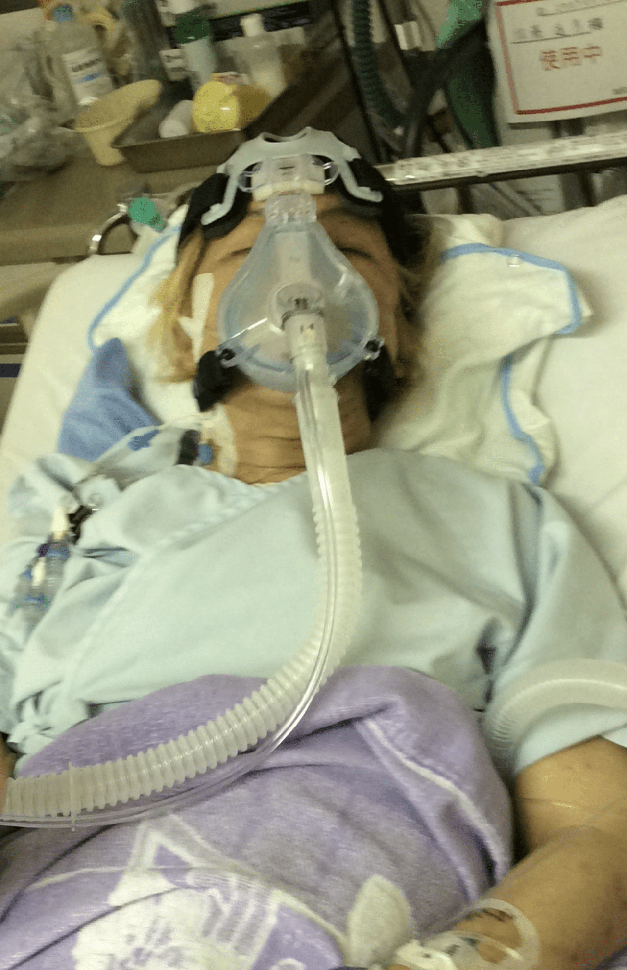 2017年の心臓バイパス手術直後の南部虎弾さん