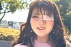 《ギャルメイクへの憧れが原点》生まれつきの顔の病気で〈18年で15回の手術〉を乗り越え「おしゃれ眼帯ブランド」を立ち上げた理由
