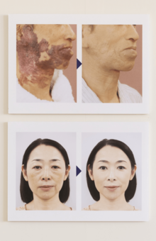 5月4～10日限定で、大阪・関西万博に体験ブースを出典。未来を見据えた医療として、リハビリメイクを紹介した