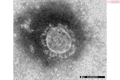 新型コロナ「A型と薄毛」の人は重症化する? 最新研究の真相を専門家に聞く