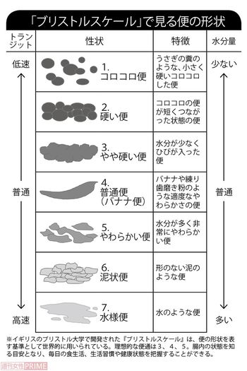 「ブルリストルスケール」で見る便の形状