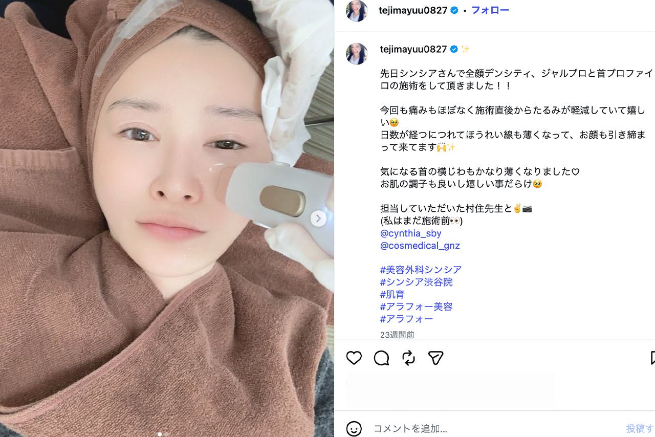 美容クリニックで美肌ケアを行う手島優（公式Instagramより）
