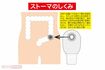 ストーマのしくみ